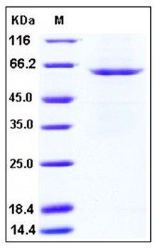 SDS-PAGE analysis of human SMPD1 His tag protein