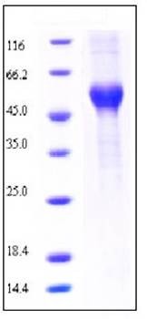 SDS-PAGE analysis of rat ALK1 Fc His tag protein