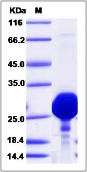 SDS-PAGE analysis of human GOPC protein (His Tag)