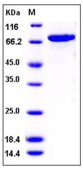 SDS-PAGE analysis of human CDC42BPB His GST tag protein