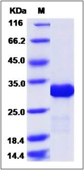 SDS-PAGE analysis of IMP1 (His Tag) protein
