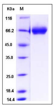 SDS-PAGE analysis of Human TRP1 protein (His Tag)