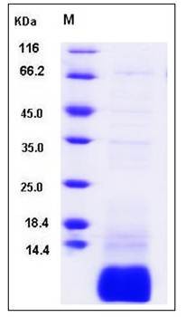 SDS-PAGE analysis of human GNGT1 protein (His Tag)