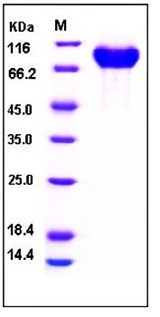 SDS-PAGE analysis of Human PIGR His tag protein