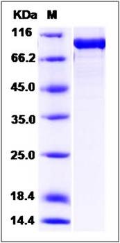 SDS-PAGE analysis of Human OPTN protein (GST Tag)