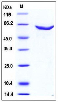 SDS-PAGE analysis of human TRDMT1 GST tag protein