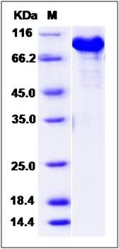 SDS-PAGE analysis of Human KIAA1279 protein (GST Tag)
