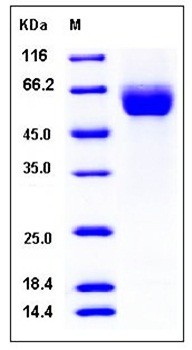 SDS-PAGE analysis of Human ROBO4 His tag protein