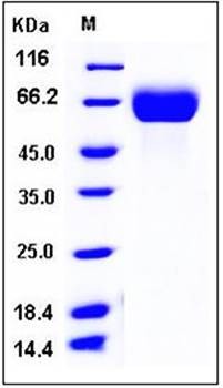 SDS-PAGE analysis of mouse FGFR1 His tag protein
