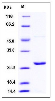 SDS-PAGE analysis of Mouse PRDX1 His tag protein
