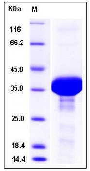 SDS-PAGE analysis of human FDPS protein (His Tag)