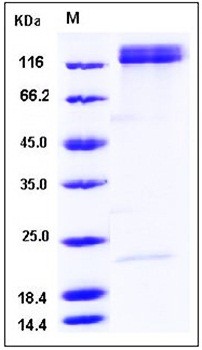 SDS-PAGE analysis of Human ITGA5 flag His tag protein