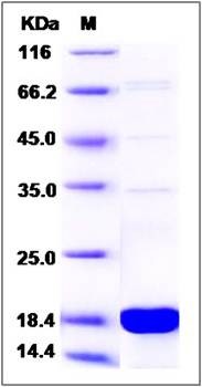 SDS-PAGE analysis of human SUB1 protein (His Tag)