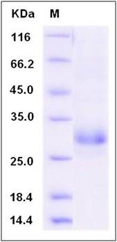SDS-PAGE analysis of rat CLEC4D protein (His Tag)