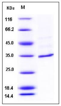 SDS-PAGE analysis of human FANCA protein (His Tag)