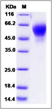 SDS-PAGE analysis of Mouse IL1R2 protein (His Tag)