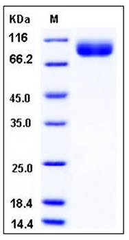 SDS-PAGE analysis of human BCHE His tag protein