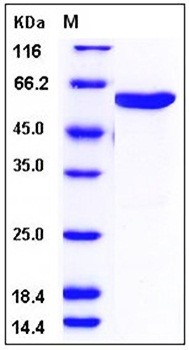 SDS-PAGE analysis of Human MKK6 His GST tag protein