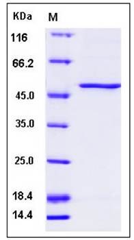 SDS-PAGE analysis of Human PAH protein (His Tag)
