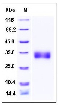 SDS-PAGE analysis of rat SOST His tag protein