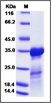 SDS-PAGE analysis of H3N2 M1 protein (His Tag)
