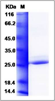 SDS-PAGE analysis of human CYGB protein (His Tag)