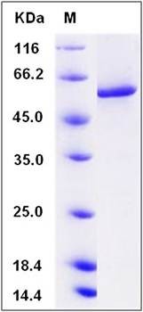 SDS-PAGE analysis of Human PPP3CA protein (His Tag)