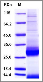 SDS-PAGE analysis of mouse ApoAI protein (His Tag)
