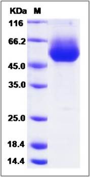 SDS-PAGE analysis of Cynomolgus IL18R1 protein (His Tag)