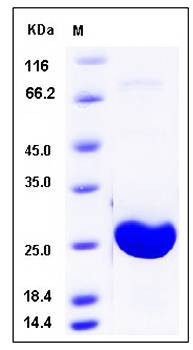 SDS-PAGE analysis of human AK1 protein (His Tag)
