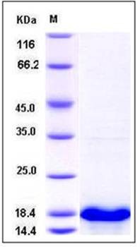 SDS-PAGE analysis of Human UBE2D4 protein (His Tag)