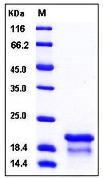 SDS-PAGE analysis of Human NPM1 His tag protein