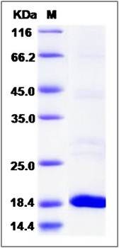 SDS-PAGE analysis of Human RIFK protein (His Tag)