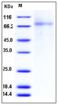 SDS-PAGE analysis of Human PLTP His tag protein
