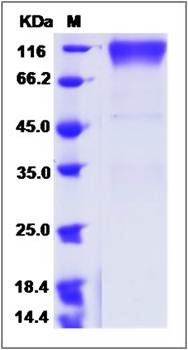 SDS-PAGE analysis of CEACAM1 protein