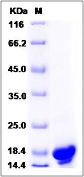 SDS-PAGE analysis of Human PFDN4 protein (His Tag)