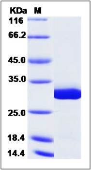 SDS-PAGE analysis of GSTM5 (His Tag) protein