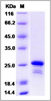 SDS-PAGE analysis of human CBFB protein (His Tag)