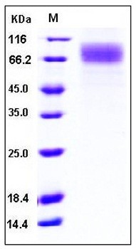 SDS-PAGE analysis of Human SCARB1 His tag protein