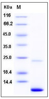 SDS-PAGE analysis of Human S100A11 protein