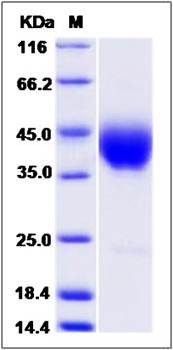 SDS-PAGE analysis of human SLAMF6 protein