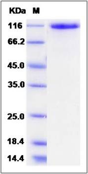 SDS-PAGE analysis of human ROBO2 protein (His Tag)