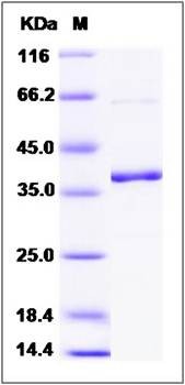 SDS-PAGE analysis of Human MKK6 protein