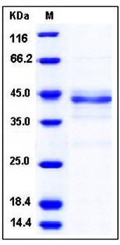 SDS-PAGE analysis of human TRIB2 protein