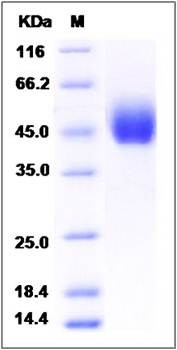 SDS-PAGE analysis of human DPEP2 protein