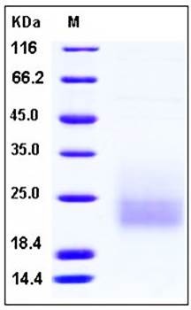 SDS-PAGE analysis of Human CD3D His tag protein