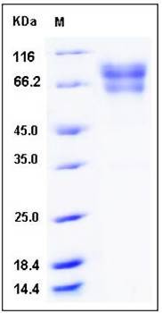 SDS-PAGE analysis of human F9 His tag protein