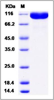 SDS-PAGE analysis of Cynomolgus PTGFRN protein (His Tag)