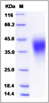 SDS-PAGE analysis of human GI24 protein (His Tag)