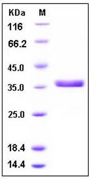 SDS-PAGE analysis of human CTSS His tag protein